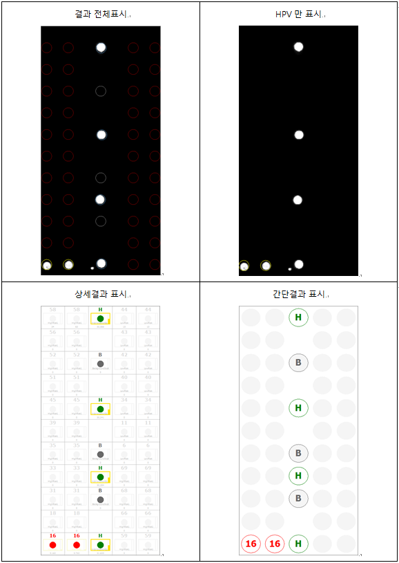 의료 Chip 이미지 프로세싱 - HPVDNA Chip Medical Chip Image Processing