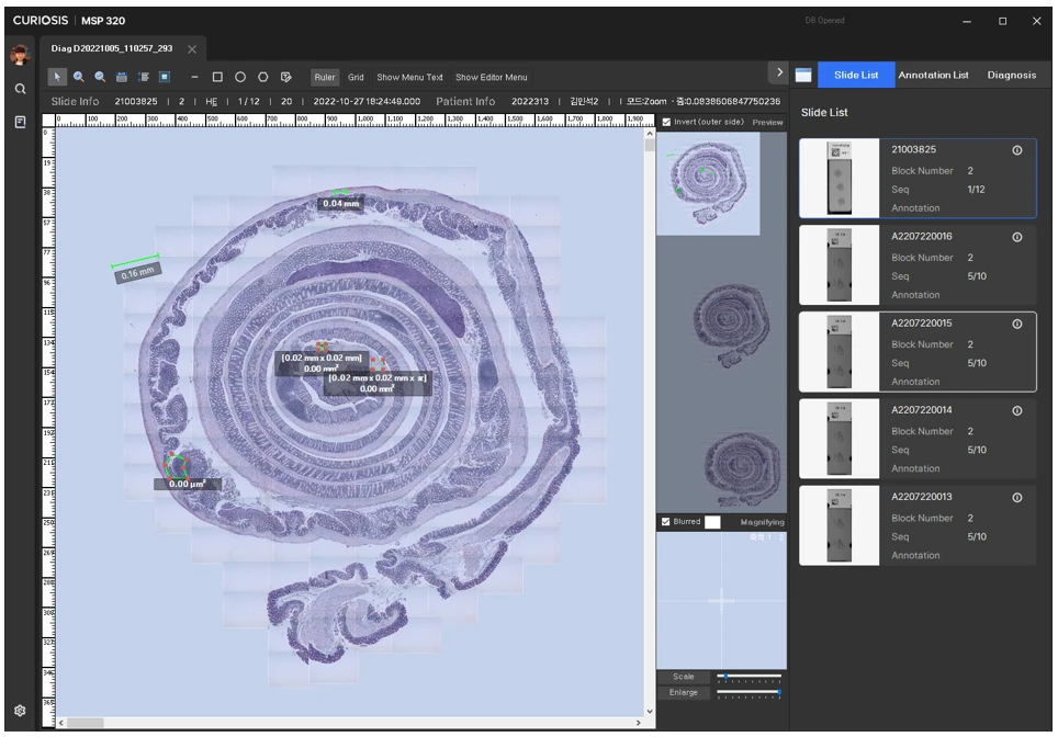 [Curiosis] 스티칭 및 캐쉬형 뷰어, Image registration/stitching viewer
<br>스티칭 및 캐쉬형 뷰어
<br> ㆍ개발언어: C#(Framework4.5.2)
 ㆍ개발툴: Microsoft Visual Studio 2019, 2022
 ㆍ개발시기: 작업 시기 :  2022. 6
<br>