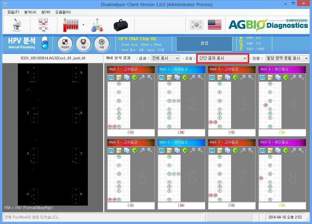 [Dnaanalysor] Spot Auto Positioning 및 이미지 Processing , Reprot Export(csv , xps)
<br>HPV DNA Chip의 검사 후 진단에서 판독기준에 따라 자동으로 판독하여 고객의 편의성을 높이고 판독의 오류를 막음
<br> ㆍ개발언어: Microsoft .Net Framework 4.0(C# Winform - Client Profile 환경)
 ㆍ개발툴: Visual Studio 2012 SP 1
 ㆍ개발시기: 2014. 1 ~ 2014. 3
<br>